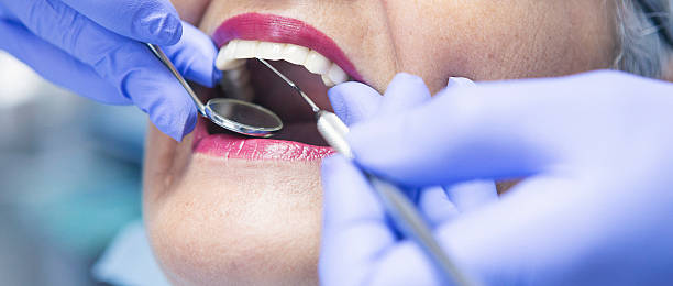Best Emergency Dentist for Lost Fillings or Crowns in Spring Grove, PA